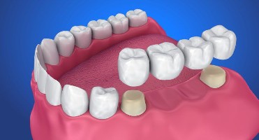 featured project
